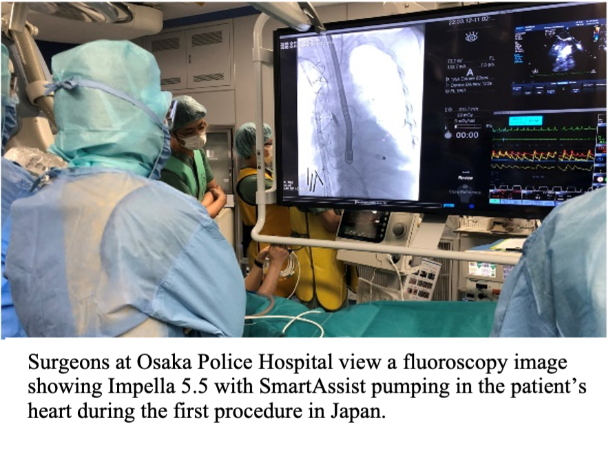 Surgeons at Osaka Police Hospital view a fluoroscopy image showing Impella 5.5 with SmartAssist pumping in the patient’s heart during the first procedure in Japan.