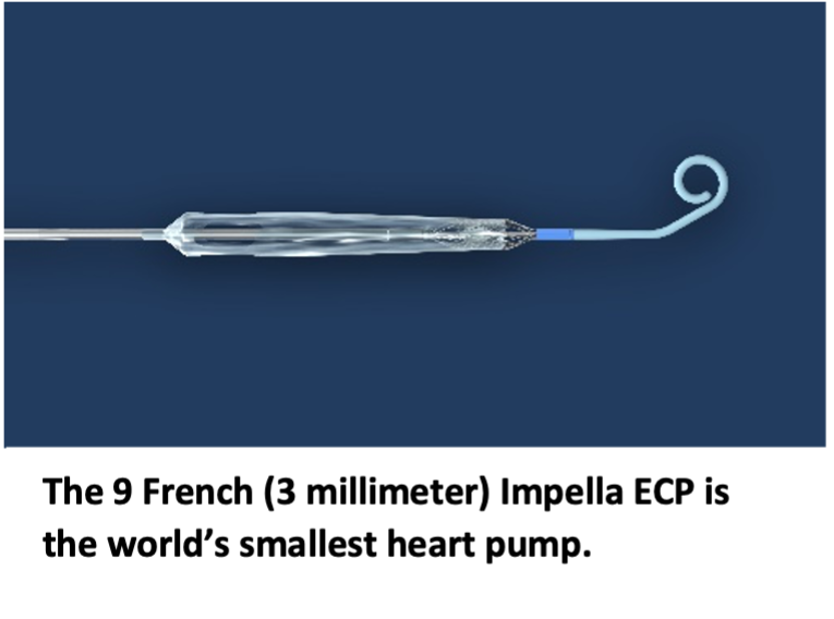The 9 French (3 millimeter) Impella ECP is the world’s smallest heart pump.